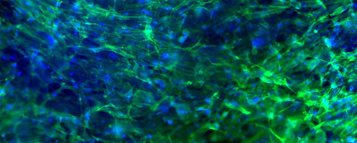 Ausbreitung der Zellen im gedruckten Objekt